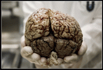 brain